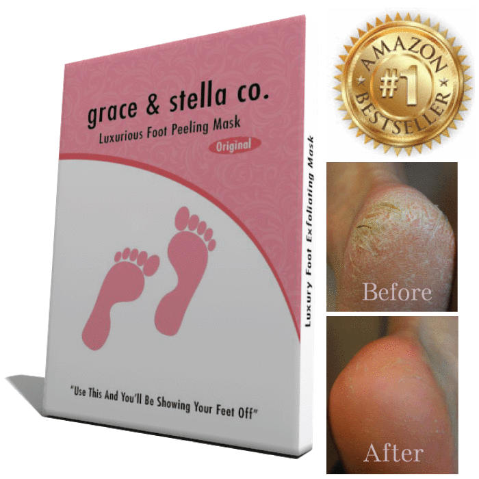 @Graceandstella foot mask before and after via @chgdiapers